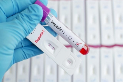 Test na prisustvo Helicobacter pylori i okultno krvarenje u stolici